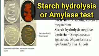 Starch hydrolysis Test Amylase test biochemical test lecture 13 [upl. by September945]