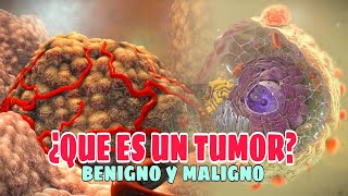 ✅Qué es un TUMOR Tipos Causas Síntomas Tratamiento✅ [upl. by Zelten]