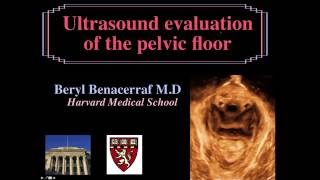 AIUM Webinar Ultrasound Evaluation of the Pelvic Floor [upl. by Karel]