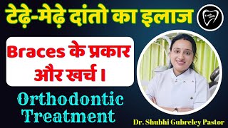 टेढ़ेमेड़े दांतो का इलाज।।types of Braces।।orthodontic treatment।। braces cost [upl. by Lizzy]