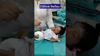 Neonatal Reflexes in Newborn baby newborn shortvideo [upl. by Ytsirt437]