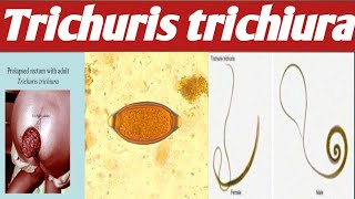 Trichuris trichiura  Ahmaric Tutorial [upl. by Qidas]