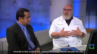 Pathology Insights Pleural Fluid  CytoHisto Correlation [upl. by Rastus861]