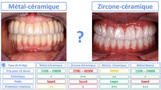 All on 4  MétalCéramique ou ZirconeCéramique [upl. by Marne568]