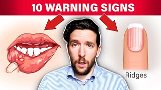 10 WARNING Signs That Your Stomach Acid Is Low [upl. by Ladin]