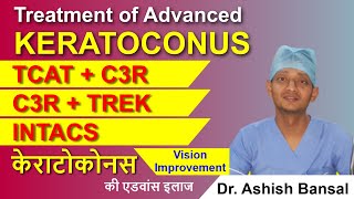 Advanced Keratoconus Treatment C3R Plus TCAT with C3R TREK INTACS  Keratoconus Surgery [upl. by Peria523]