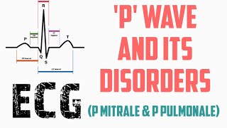 ECG P Wave amp its disorder Mitrale amp Pulmonale  ECG made Easy  ECG Lecture Part5  EKG [upl. by Llerral]