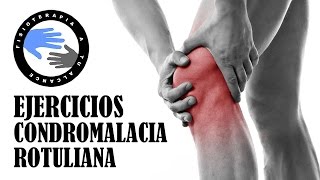 Ejercicios para condromalacia rotuliana o patelar [upl. by Andromeda]