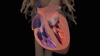 Heart failure treatment  Late stages  Circulatory System and Disease  NCLEXRN  Khan Academy [upl. by Liarret]