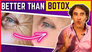 ERASE CROWS FEET IN DAYS WITHOUT BOTOX [upl. by Worthy]