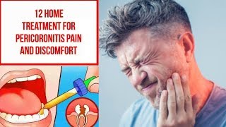 12 Home Treatment For Pericoronitis Pain and Discomfort [upl. by Twyla]