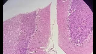 Histology of Cerebellum slide identification and explanation [upl. by Irehc703]