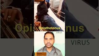 tetanus tetanusvaccine virus vaccination health healthtips shortvideo healthtips facts [upl. by Sadye]