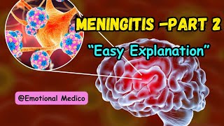 Meningitis  Part 2  CNS pathology  Robbins  emotionalmedico [upl. by Anivle]