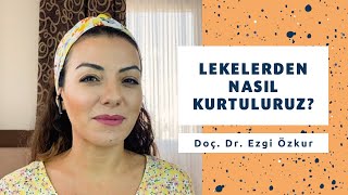 Lekelerden Nasıl Kurtuluruz Lekeler Nasıl Geçer  Doç Dr Ezgi Özkur [upl. by Cud12]