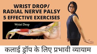 5 EFFECTIVE EXERCISES FOR WRIST DROP  RADIAL NERVE PALSY कलाई ड्रॉप के लिए 5 प्रभावी व्यायाम [upl. by Suoirred]