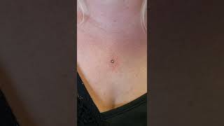 The Piercings MicroDermal Piercing by Ferry wwwthepiercingseu  Instathepierc [upl. by Naujud]