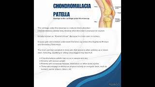 Chondromalacia Patella KNOWLEDGE AROUND  WELCOME TO KNOWLEDGE AROUND I knowlegdearound [upl. by Ody325]