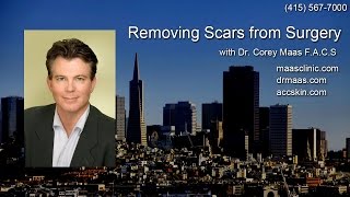 Can I Remove a Scar from Brow Lift Surgery [upl. by Will]