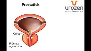 ¿Prostatitis que no es Prostatitis ¿Cistitis que no es Cistitis  Urología UROZEN [upl. by Borgeson]