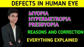 Defects in human eye and their correction  Myopia hypermetropia and presbyopia  Full explanation [upl. by Reld]