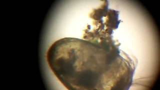 Crazy Ostracod Feeding [upl. by Adda]