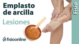 Emplasto de arcilla para esguinces contusiones inflamaciones y desgarros musculares [upl. by Skier]