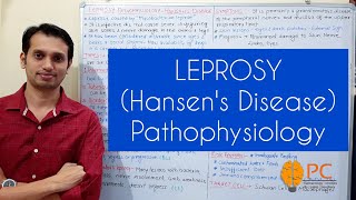 Leprosy Pathophysiology Hansens Disease Part 1 Introduction Types and Etiology [upl. by Finley]