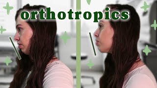 I Tried Orthotropics and Now I Dont Need Jaw Surgery  Mewing [upl. by Ping187]