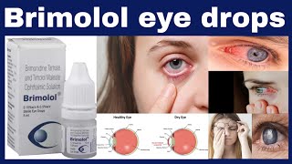 Brimolol eye drops uses in hindi  Timolol 5 mg  Brimonidine 15 mg benefits Side Effects [upl. by Kcirrej]