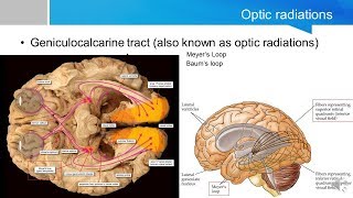 Neurosurgery written board crash course  visual cortex and visual processing [upl. by Accem366]