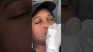 Dealing with nose piercing bumps✨ See how Base Laboratories Piercing Bump Treatment works [upl. by Annoek544]