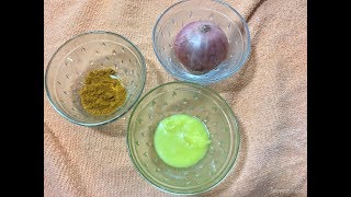 Home Remedy for Boils  Mane maddu for kuru [upl. by Kyte630]