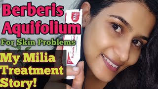 Berberis Aquifolium Homeopathic medicine for MiLIA Acne N fairness milia acne pimplesfairness [upl. by Blackwell]