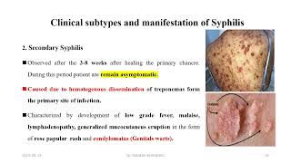 Treponema pallidiumSpirochetes [upl. by Aromat]