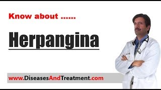 Herpangina  Causes Diagnosis Symptoms Treatment [upl. by Netsua]