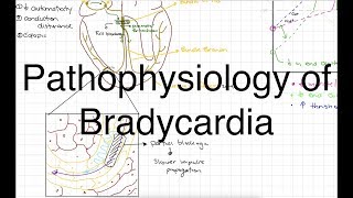 Pathophysiology of Bradycardia [upl. by Lanrev]