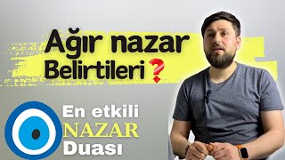 Ağır nazar belirtileri  En etkili nazar duası dua allah zikir ayet dinihikayeler [upl. by Nadaha]