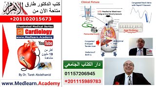 Constrictive Pericarditis cme internalmedicine medical usmle محاضراتباطنة [upl. by Ruthann]