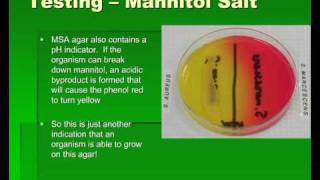 Introduction to Streptococcus [upl. by Tonia]