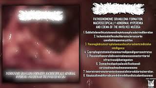 Cobblestoning  Pathognomonic Granuloma Formation FULL EP 2024  Goregrind [upl. by Laverna668]