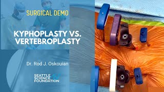 Kyphoplasty vs Vertebroplasty  Rod J Oskouian Jr  MD [upl. by Akkahs]