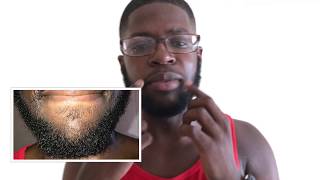 Growing a Beard With Minoxidil A Black Mans Experience Week 48 [upl. by Markiv]