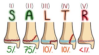 SalterHarris Classification Made Easy To Remember [upl. by Mordy]