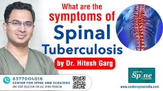 Symptoms of Spinal Tuberculosis SPINE TB  Potts disease  Dr Hitesh Garg  Spine Surgeon India [upl. by Eitsud]