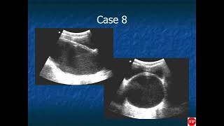 RADIOLOGY EXAM CASES [upl. by Dode]