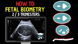 How to Perform Fetal Biometry in the Second and Third Trimesters  Practical Guide [upl. by Zacharie474]