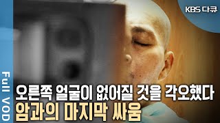 암이 빼앗아간 반쪽… 뼈는 종양으로 인해 녹고 눈은 실명 음식을 먹는 즐거움도 잊어 버렸다 얼굴 찾기 그 마지막 도전  현장기록 병원  KBS 20070206 방송 [upl. by Yroger917]