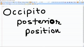 Occipito Posterior Position  types and Management [upl. by Reichert]