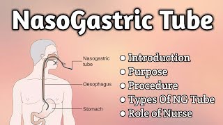 Nasogastric Tube Intubation [upl. by Evangelia808]